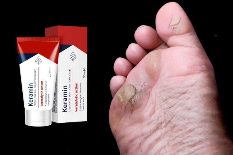 Keramin apteka in Poland Keramin apteka in Poland